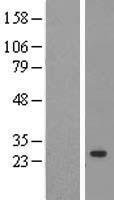 PPIC Human Over-expression Lysate