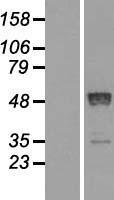 Retinoic Acid Receptor beta (RARB) Human Over-expression Lysate