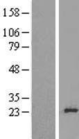 RPL24 Human Over-expression Lysate