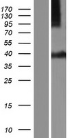 Syntaxin 16 (STX16) Human Over-expression Lysate