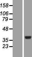 NT5C3 (NT5C3A) Human Over-expression Lysate
