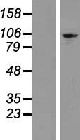 EXOSC10 Human Over-expression Lysate