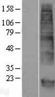 GPM6B Human Over-expression Lysate