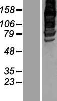 AFAP1L2 Human Over-expression Lysate