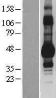 DDI1 Human Over-expression Lysate