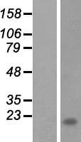 LINC02145 Human Over-expression Lysate