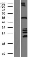ZFYVE27 Human Over-expression Lysate