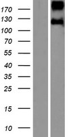 Leptin Receptor (LEPR) Human Over-expression Lysate