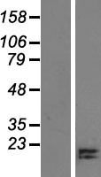 CCDC196 Human Over-expression Lysate