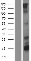 Her2 (ERBB2) Human Over-expression Lysate