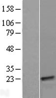 TXLNGY Human Over-expression Lysate
