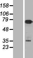 NUMB Human Over-expression Lysate