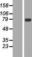 NUMB Human Over-expression Lysate