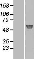 GBA Human Over-expression Lysate