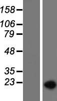SAP155 (SF3B1) Human Over-expression Lysate