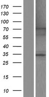 IKB zeta (NFKBIZ) Human Over-expression Lysate