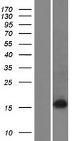 ZSCAN2 Human Over-expression Lysate