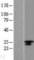LRRC18 Human Over-expression Lysate
