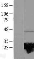 RAB37 Human Over-expression Lysate