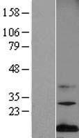 Midkine (MDK) Human Over-expression Lysate