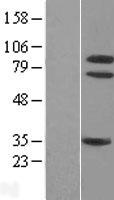 TrkA (NTRK1) Human Over-expression Lysate