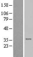 CENPP Human Over-expression Lysate