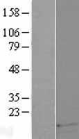 DEFB121 Human Over-expression Lysate