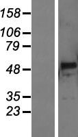 PNLIPRP3 Human Over-expression Lysate