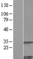 MCCD1 Human Over-expression Lysate