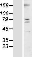 TMEM44 Human Over-expression Lysate