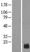 GUSBP5 Human Over-expression Lysate