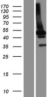 HERPUD1 Human Over-expression Lysate