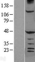 HERPUD1 Human Over-expression Lysate