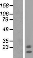 C1orf130 (NCMAP) Human Over-expression Lysate