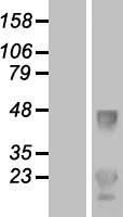 LDLRAD1 Human Over-expression Lysate