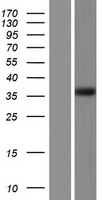CALHM6 Human Over-expression Lysate