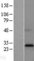 PTPLAD2 (HACD4) Human Over-expression Lysate