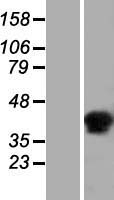 C6orf58 Human Over-expression Lysate