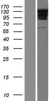 RSPH4A Human Over-expression Lysate