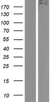 TDRD6 Human Over-expression Lysate