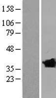 CLVS2 Human Over-expression Lysate