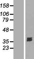 Deoxyribonuclease I like 1 (DNASE1L1) Human Over-expression Lysate