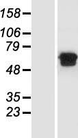MGAT2 Human Over-expression Lysate