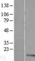 UFSP1 Human Over-expression Lysate