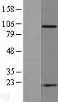 PSMA (FOLH1) Human Over-expression Lysate