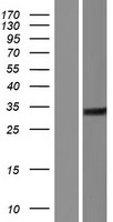 C1QTNF12 Human Over-expression Lysate