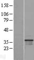 C16orf93 (CCDC189) Human Over-expression Lysate