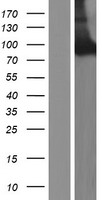 Neurochondrin (NCDN) Human Over-expression Lysate