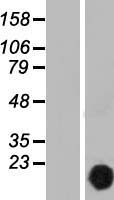 CUTA Human Over-expression Lysate