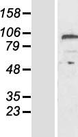 Carboxypeptidase Z (CPZ) Human Over-expression Lysate